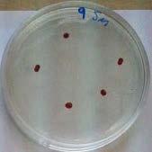 (a): This plate shows a representative sample, isolate 35, which was determined to have surface motility.