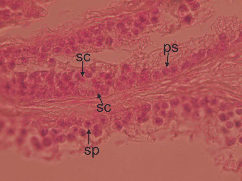spermatids, and spermatozoa released in the lumen of the seminiferous tubules.