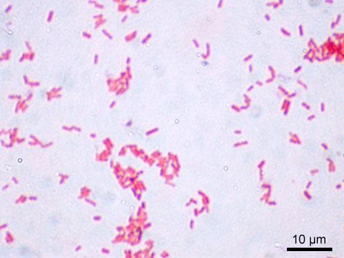 Causative agents : 32 zoonotic ; 5 foodborn without zoonotic potencial, 4 waterborn 1. Salmonella spp. 23. Lyssavirus 2. Escherichia coli 24. Influenza virus 3. Yersinia spp. 25.
