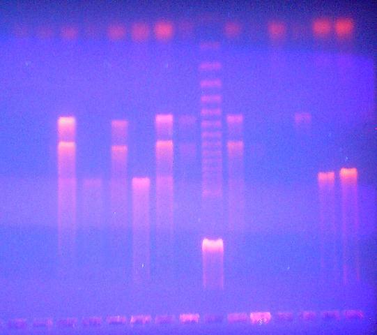their DNA dilutions. Lanes 1 to 9 and 11 to 15 from clinical isolates; Lane 10, 50-bp ladder marker; Lane 16, positive control; Lanes 17 and 18, negative controls. Eleven out of the 36 (30%) S.