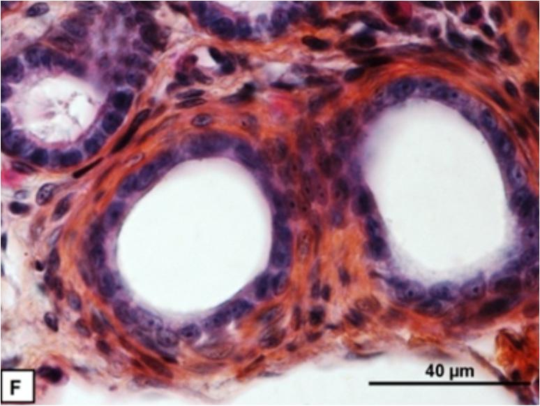 (b) Empty epididymis lumen during the early recrudescence phase. (c) All cell categories were observed in the seminiferous tubules during the autumnal spermiogenesis.