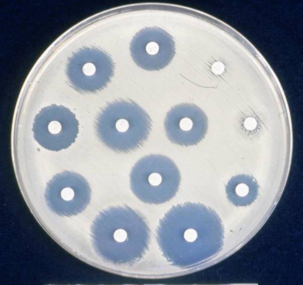 Antimicrobial Susceptibility testing can be down by the ways: 1.