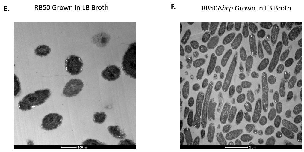 B) Quantification of bacterial volume of RB50 and RB50Δhcp using ImageJ for length measurement and