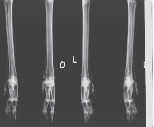 digits 3 and 4, along the medial side of the 3 rd metatarsal bone there was an additional