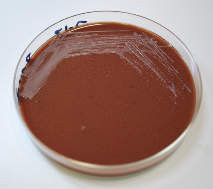 Microbiology Work-Up 10 cc purulent neck mass fluid sent to micro for culture After 5 days: