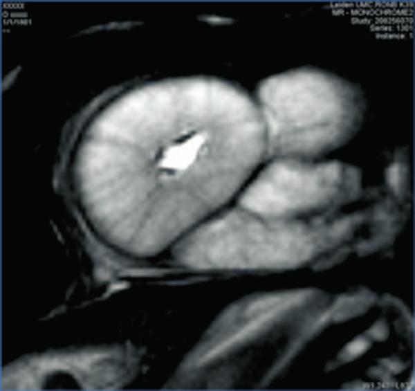 Movie S3: Longitudinal MRI scans of Varanus komodoensis