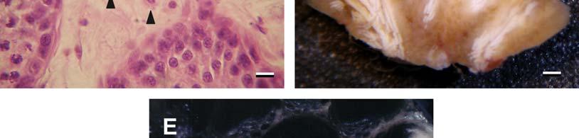 C: Leydig cells (arrowheads) in the testicular interstice. Bar = 10 μm.
