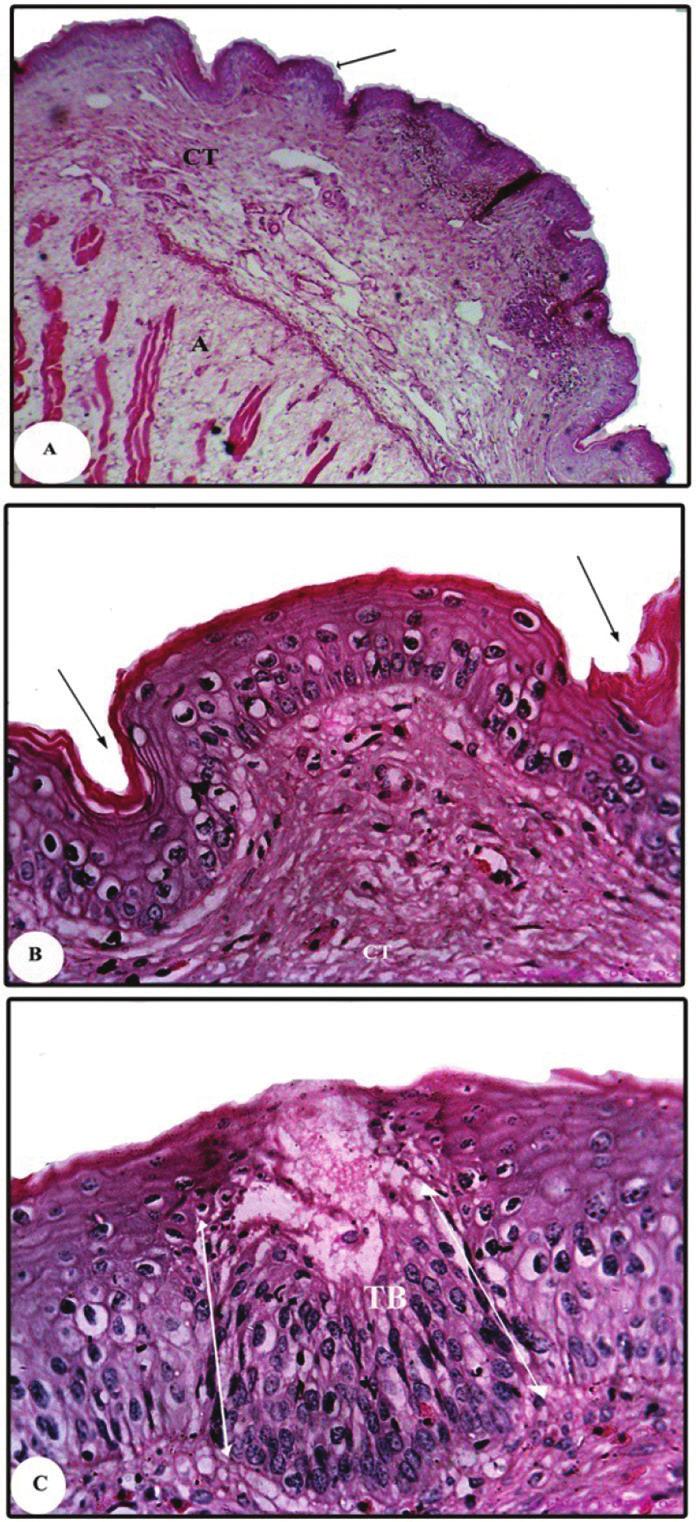 A.M. El-Bakry, H. Hamdi, Fine structure of the dorsal lingual epithelium in T. annularis and C.