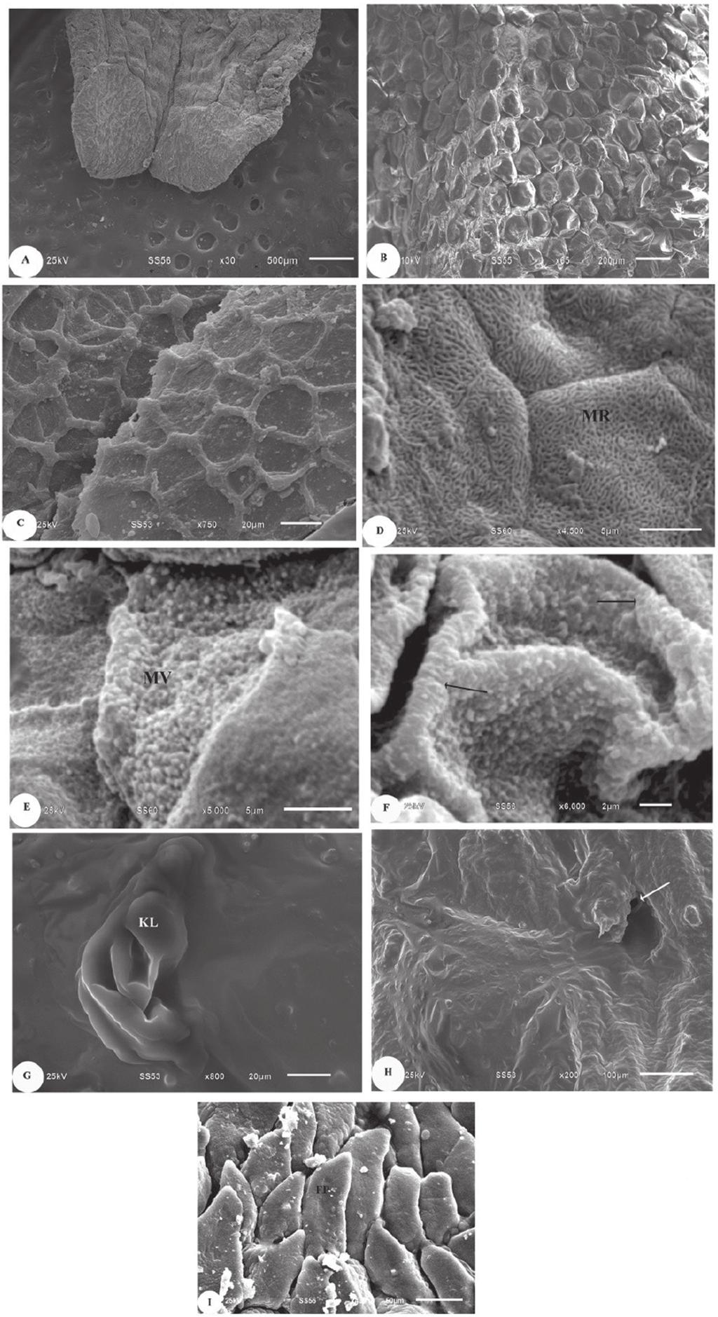 Folia Morphol., 2016, Vol. 75, No. 2 Figure 6. Scanning electron micrograph of the dorsal surface of the T. annularis showing: A. Flat tongue with bifurcated apex. Scale bar: 500 µm; B.