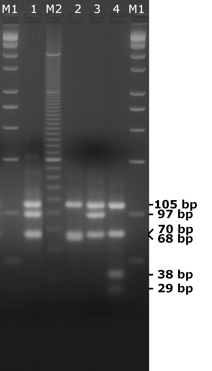 Chapter 5: Clinical and Diagnostic Features in Dogs Figure 5.1: RFLP profiles for the 5S-23S rdna intergenic spacer of samples from dog and positive controls.