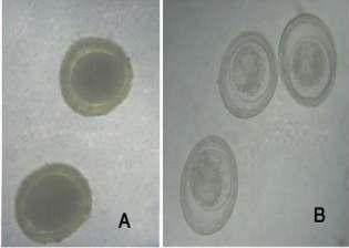Plate-1: A. Toxocara canis eggs (80 80 um). B. Toxoascaris leonine eggs (72.5 80 um).