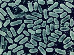 Bacterial Infection Listeria monocytogenes Listeriosis is relatively rare and occurs primarily in newborn infants, elderly patients. Symptoms last 7 10 days.(fever and muscle aches and vomiting 1.