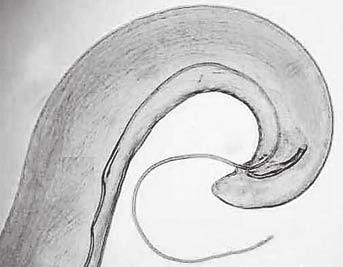 male worms had five pairs of postcloacal papillae on the ventral side of the body. The distance from the position of the cloaca to the end of the tail ranged from 69-81 μm.