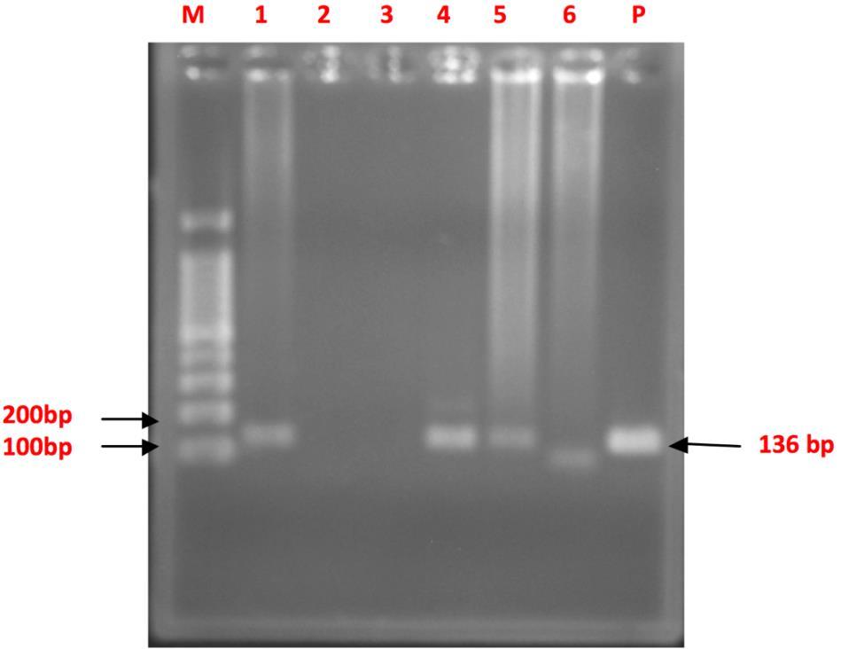 Sarker et al. 1507 Figure 1. PCR for detection of B. abortus from MRT positive milk samples. M, DNA marker (100 bp ladder); 1 to 6 samples; P, positive control.