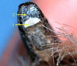 The mottled light and dark tissue (2) is the top part of the nail.