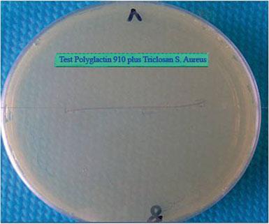average. The intralesional portion of each suture, recognisable by the greater humidity and altered colour, was dissected under sterile conditions.
