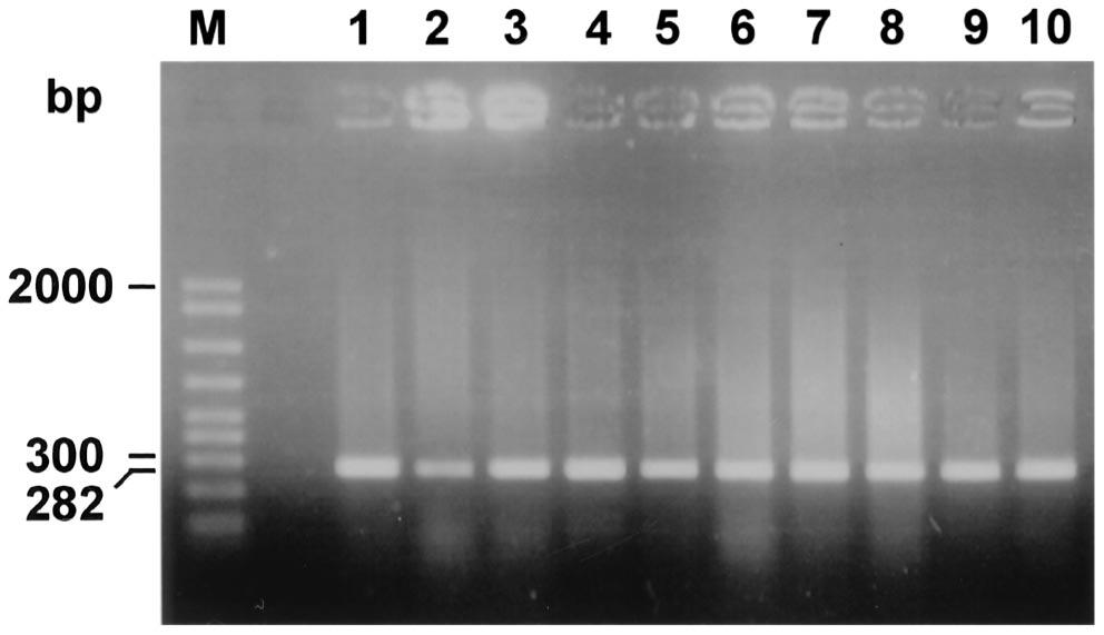 VOL. 40, 2002 PCR ANALYSIS OF BRUCELLA omp2 PstI SITE POLYMORPHISM 1477 FIG. 1. Agarose gel electrophoresis of PCR-amplified omp2 gene fragments from Brucella prototype strains.