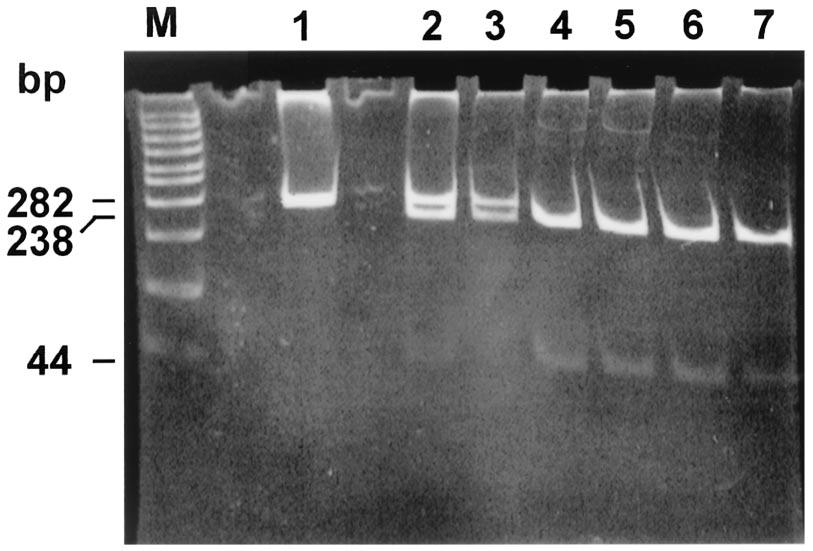 Ten microliters of the amplified product was analyzed by electrophoresis in 1.5% agarose gels in TEA buffer (20 mm Tris-acetate, 1 mm EDTA [ph 8.0]). DNA digestion.