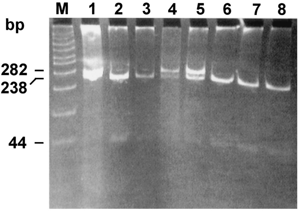 1478 BARDENSTEIN ET AL. J. CLIN. MICROBIOL. FIG. 4. Polyacrylamide gel electrophoresis of PstI digests of amplified omp2 gene fragments from atypical B.