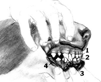 This is a correct mouth with the top incisors (1) closely overlapping the