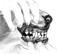 with the premolars (4) present just posterior to the canines.