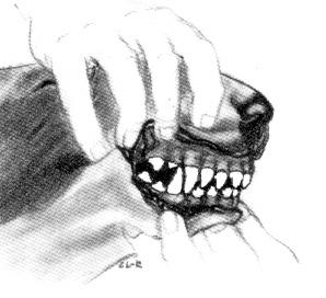well forward of the uppers and the lower canine beside or forward of the top
