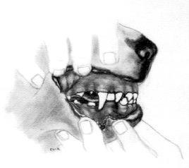 MISPLACED CANINE TOOTH A WRY MOUTH A scissors bite with a misplaced lower canine. The top half of the canine is not visible when the jaws are closed.