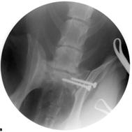 Current Trends in Veterinary Orthopedics Locking Plate Technology Fluoroscopic Assisted Surgery Current Trends in Veterinary