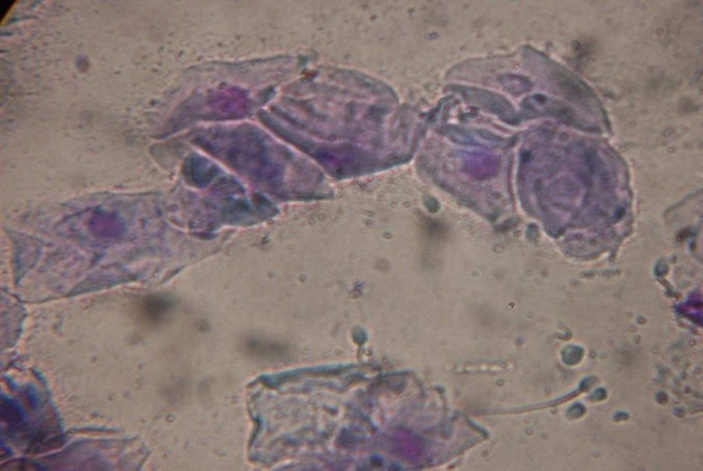 cells and presence of numerous sperm cells after mating. ( 40). GAC 45.30 54.68 LIEC 49.17 50.81 LIEC= Large Intermediate Epithelial Cell; GAC= Giant Anucleated Cell.