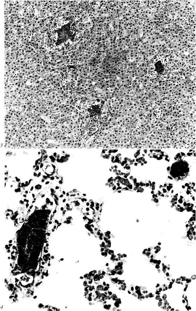 Fig. 3. Embolic suppurative hepatitis in a monkey with A.