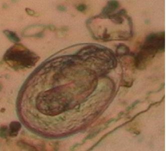 Fig. 3. Fecal examination revealed that Strongyloides egg Fig. 4.