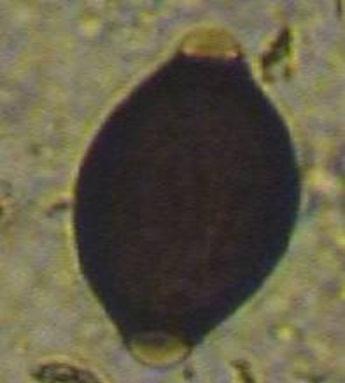 Fecal examination revealed that Trichostrongylus egg Fig. 6.