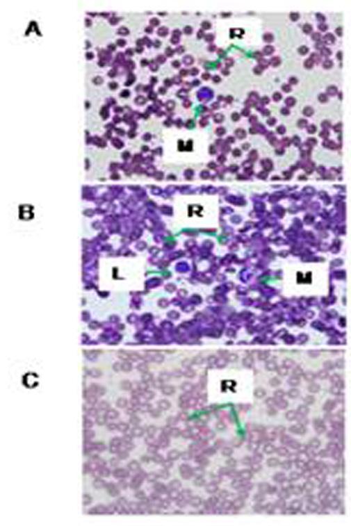 001). Figure 5 Blood films of acutely infected rat at 21 days after infection with B. abortus biotype 1 (A), subacutely infected rats at 90 days after infection with B.