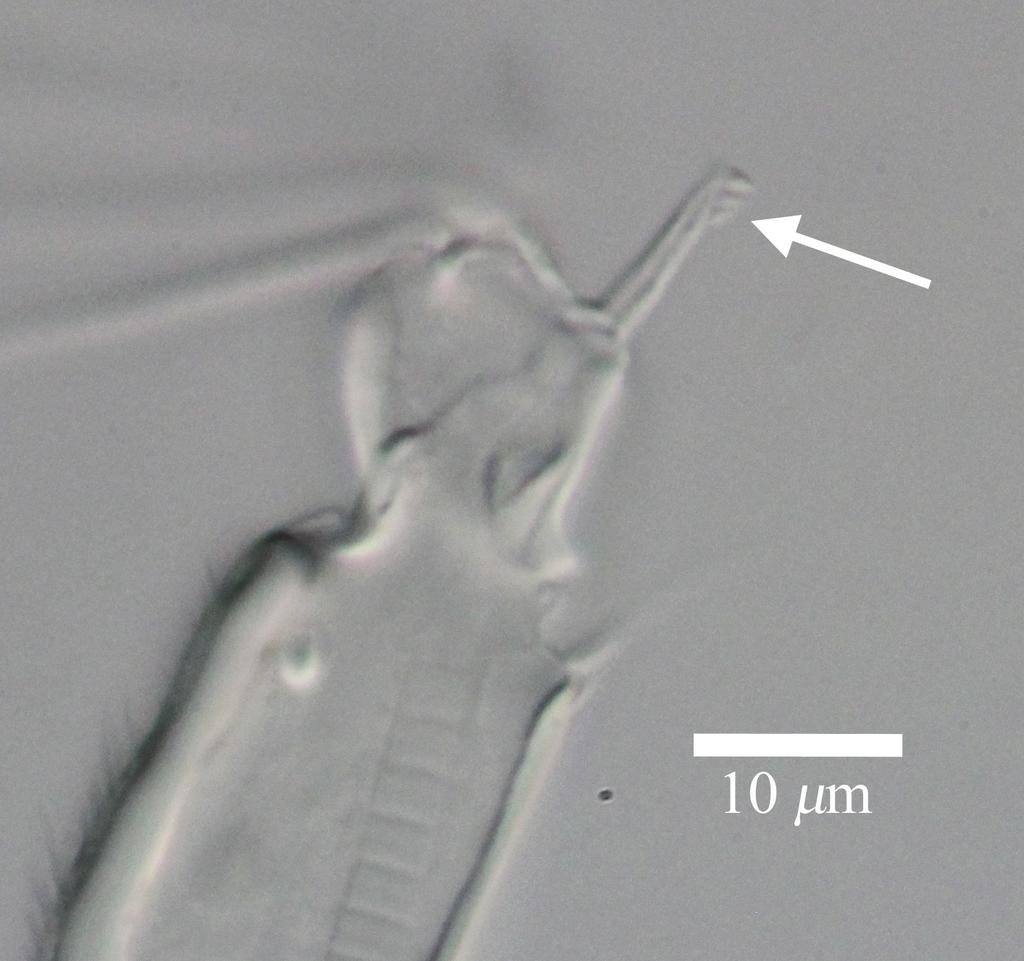 84 Hayato Tanaka & Akira Tsukagoshi / ZooKeys 294: 75 91 (2013) Figure 9. Light micrograph of male antennula of Polycopetta quadrispinata sp. n.