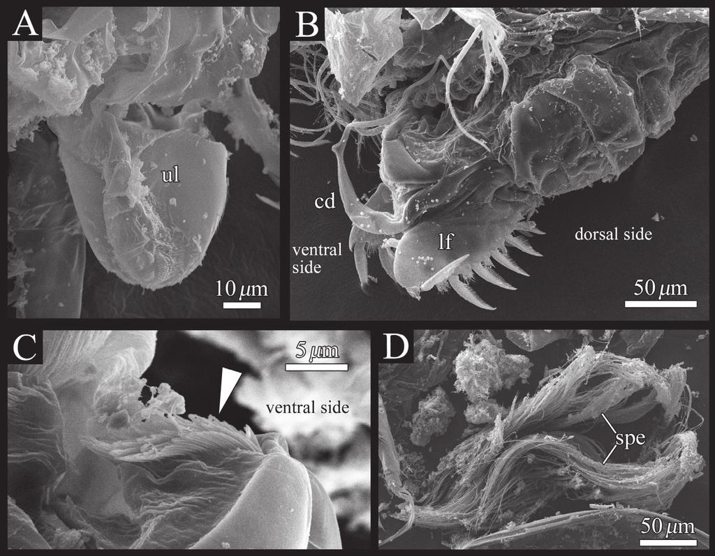 88 Hayato Tanaka & Akira Tsukagoshi / ZooKeys 294: 75 91 (2013) Figure 13. Polycopetta quadrispinata sp. n. SEM images of male soft parts of.