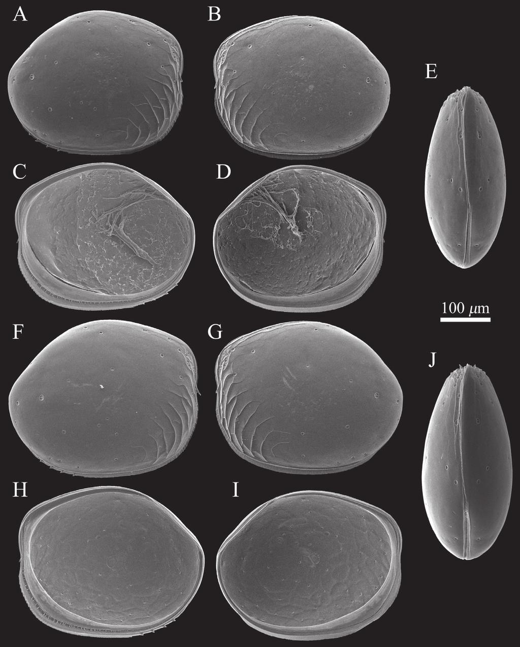 78 Hayato Tanaka & Akira Tsukagoshi / ZooKeys 294: 75 91 (2013) Figure 2. SEM images of Polycopetta quadrispinata sp. n. valves.