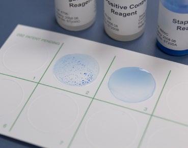 StaphTex Blue Kit A rapid latex agglutination kit which tests for both the Clumping Factor and Protein A found in Staphylococcus aureus.