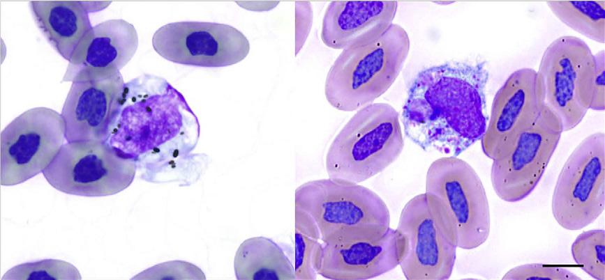 Author's personal copy Diagnostic Hematology of Reptiles 95 Fig. 8. Macrophages in peripheral blood. (Left) Melanomacrophage in a clinically healthy loggerhead sea turtle (Caretta caretta).