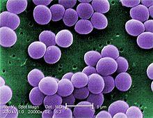 Staphylococcus aureus From Wikipedia, the free encyclopedia Staphylococcus aureus is a bacterium that is a member of the Firmicutes, and is frequently found in the human respiratory tract and on the