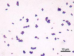 Microbiology Gram stain of S. aureus cells which typically occur in clusters. The cell wall readily absorbs the crystal violet stain. Yellow colonies of S.