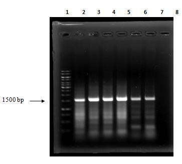 minute before centrifuge at 13 000 rpm for again 1 minute. 4.1.6 Sequencing The 18s rdna and ITS-2 rdna gene sequence were analyzed for the identification of the helminths species.