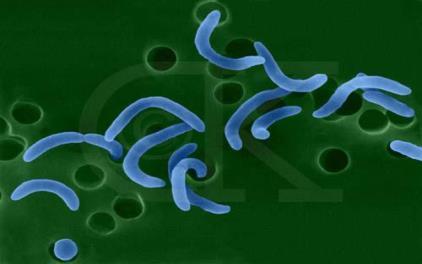 Curved Bacilli (Vibrio) Actively motile, gram-negative curved rods Vibrios are distinguished from enterics by being oxidase-positive and motile by means of polar flagella.