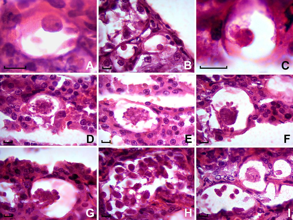 Syst Parasitol (2014) 89:83 89 85 Fig. 2 Photomicrographs of life-cycle stages of Klossiella tejerai in renal tissue from the Brazilian common opossum Didelphis aurita.