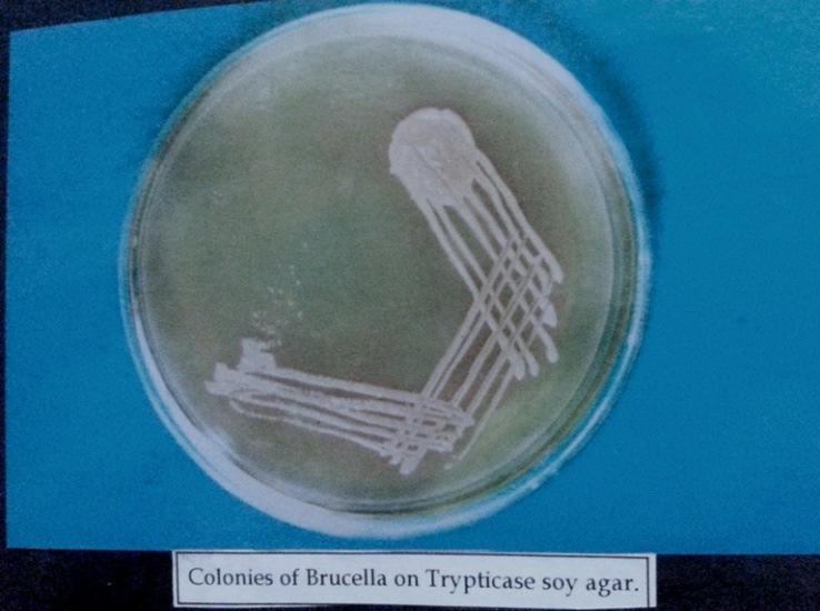 Figure 2 : Distribution of titers among brucella seropositive patients 320 IU 640 IU 1280 IU 2560 IU Figure 3 : Growth of Brucella melitensis on trypticase soy agar REFERENCES: 1. Koshi G and Myers R.