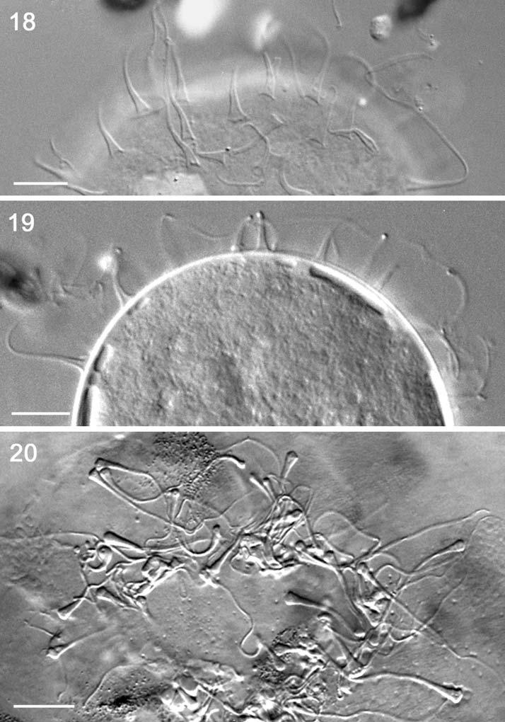 High-Alpine tardigrade Ramazzottius nivalis sp. nov. 41 Figs. 18-20. Ramazzottius nivalis sp. nov.: 18-20, processes of the eggshell (All DIC. Scale bars: 10 m). The egg processes in R.