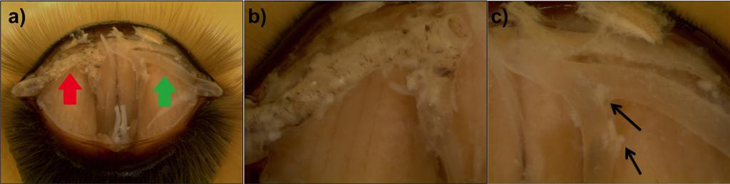 Figure 9. A honey bee s infested and healthy mesothoracic tracheae. a) Full view of both the left and right tracheae of a single bee.