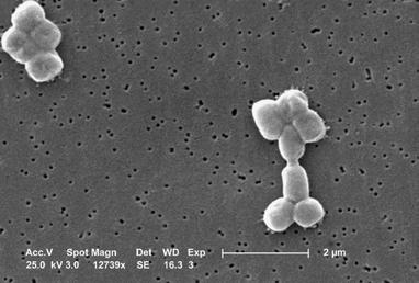 Acinetobacter baumannii Photo Credit: CDC / Janice Carr A.baumannii is a Gram-negative bacterium that can become an opportunistic pathogen in patients with compromised immune systems.
