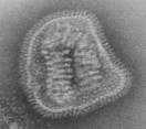 (i.e. Circovirus, APV, Fowl Pox Virus) RNA viruses