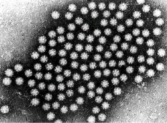 Enteric Disorders in Rabbit Evaluation of the genotipes of Astrovirus circulating in