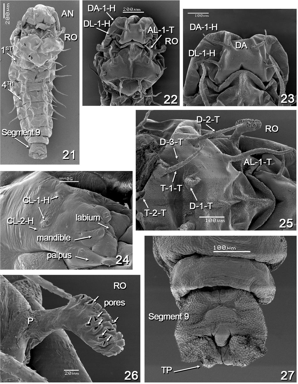 IMMATURES OF Atrichopogon delpontei 2087 Figures 21-27 - Atrichopogon delpontei, female pupa.